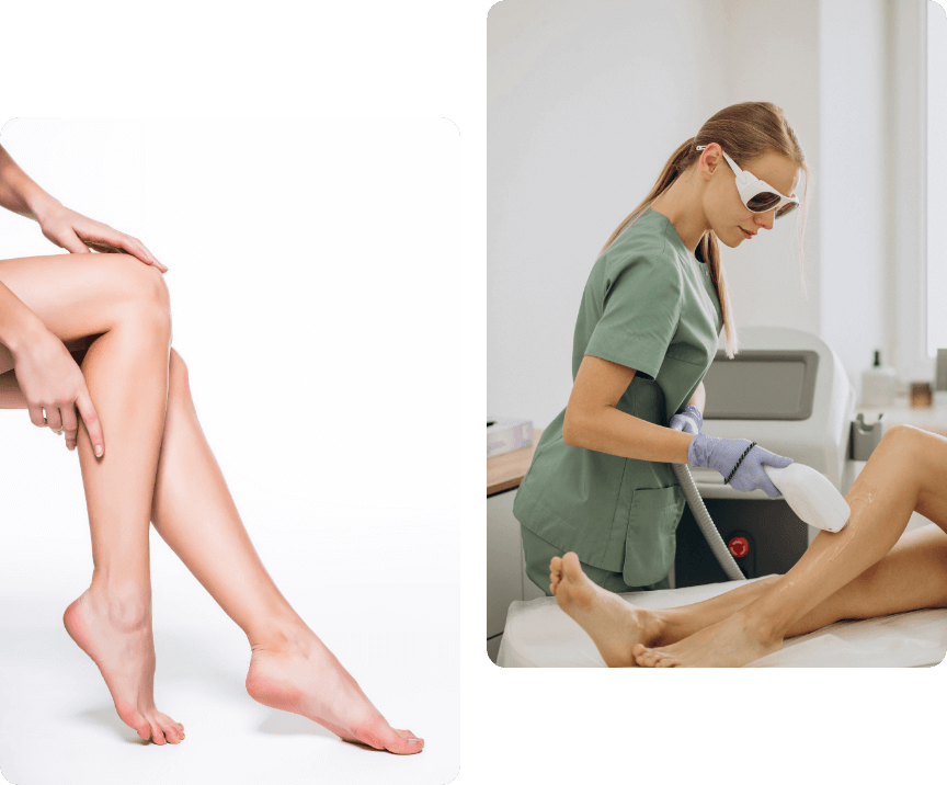 Laser hair removal in Islamabad for smooth and hair free legs