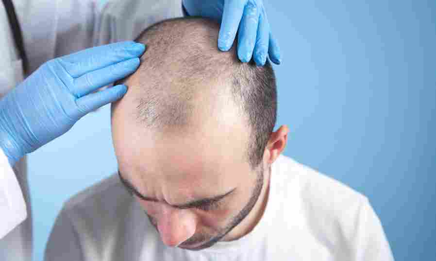 hair transplant in islamabad