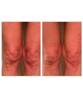 before & after post (Morpheuse8)