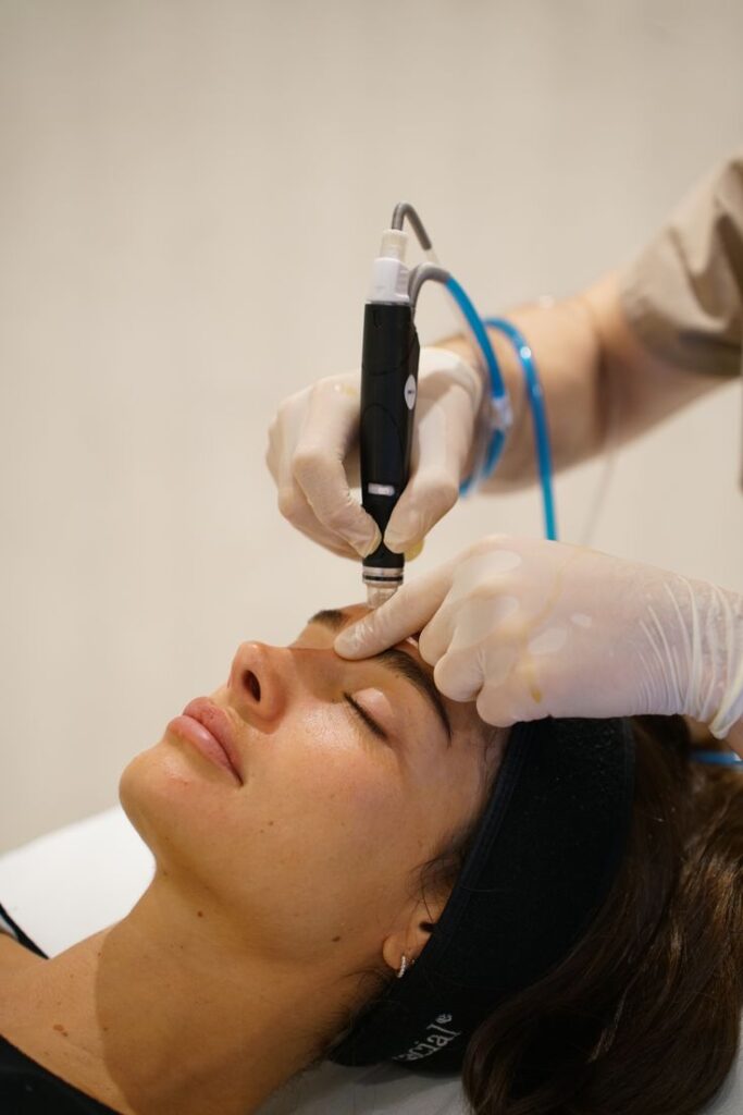Close-up Hydrafacial treatment removing blackheads and impurities